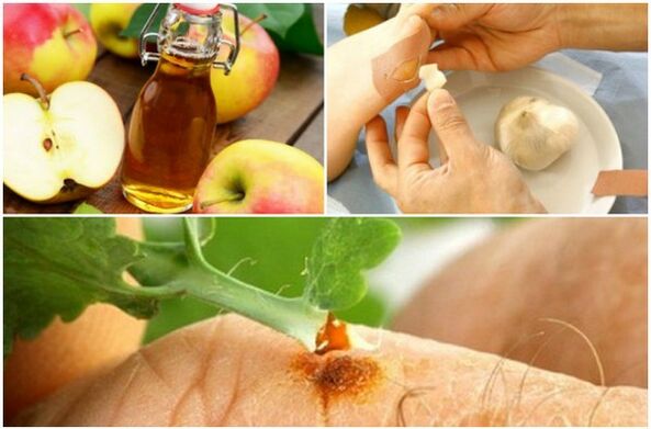 Folk remedies for warts